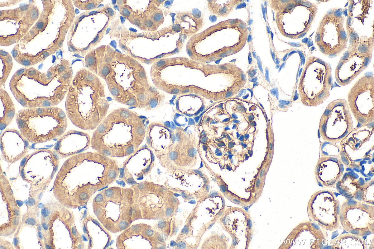 Immunohistochemistry (IHC) staining of mouse kidney tissue using FBXO27 Polyclonal antibody (14570-1-AP)