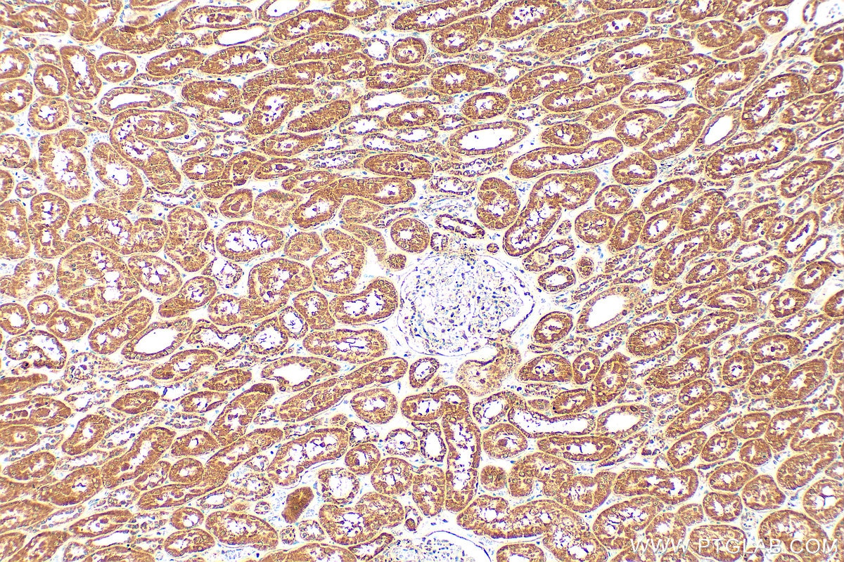 Immunohistochemistry (IHC) staining of human kidney tissue using FBXO27 Polyclonal antibody (14570-1-AP)