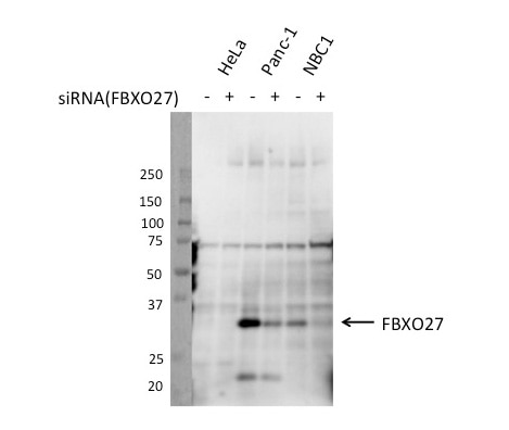 Western Blot (WB) analysis of Panc-1 cells using FBXO27 Polyclonal antibody (14570-1-AP)