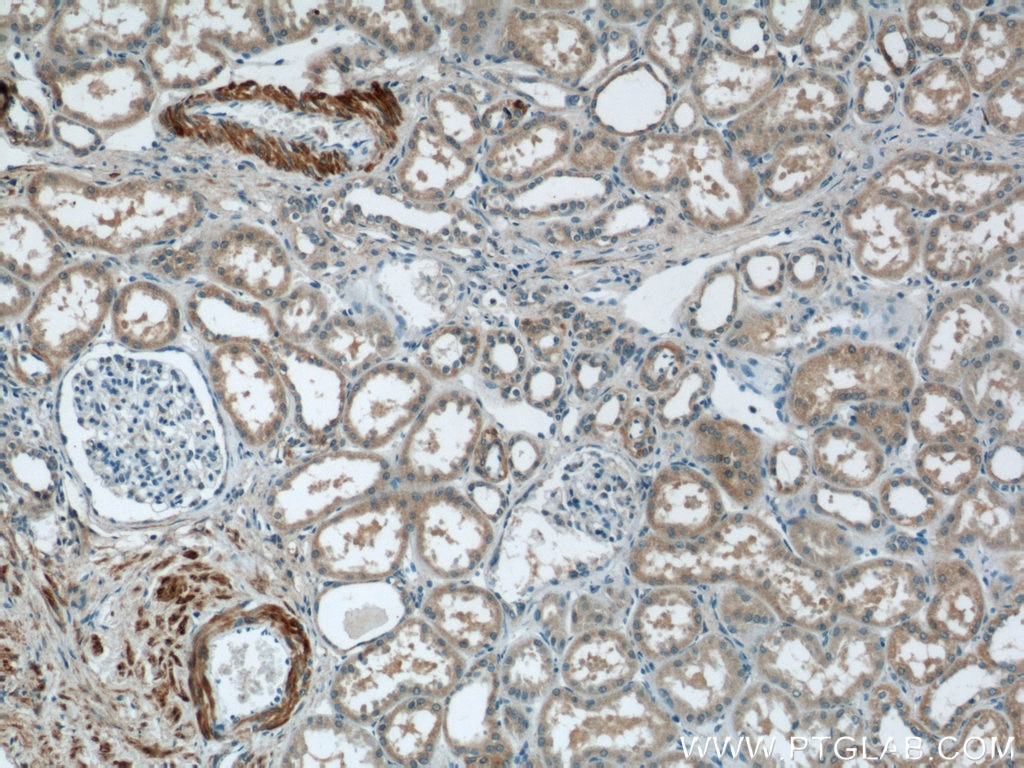 Immunohistochemistry (IHC) staining of human kidney tissue using FBXO28 Polyclonal antibody (24282-1-AP)