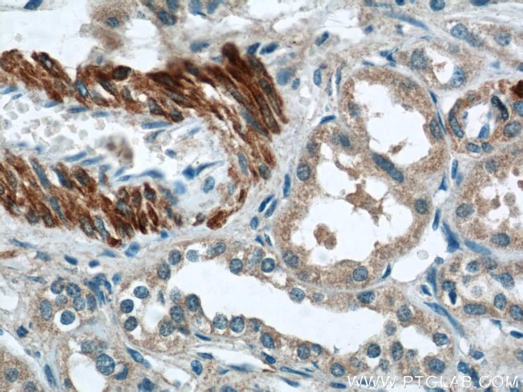 Immunohistochemistry (IHC) staining of human kidney tissue using FBXO28 Polyclonal antibody (24282-1-AP)