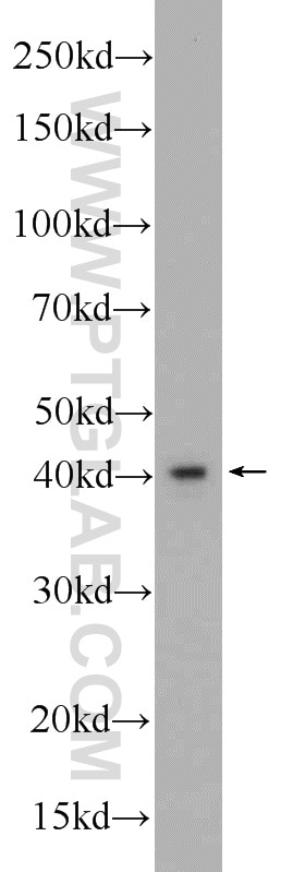 FBXO28 Polyclonal antibody