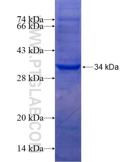 FBXO28 fusion protein Ag15977 SDS-PAGE