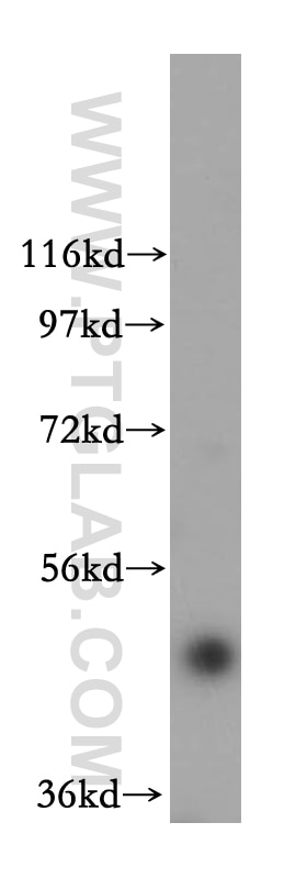 Western Blot (WB) analysis of HeLa cells using FBXO3 Polyclonal antibody (17803-1-AP)