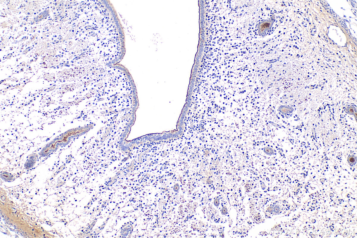 Immunohistochemistry (IHC) staining of mouse uterus tissue using FBXO31 Polyclonal antibody (27294-1-AP)