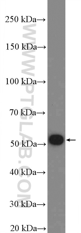 Western Blot (WB) analysis of mouse brain tissue using FBXO31 Polyclonal antibody (27294-1-AP)