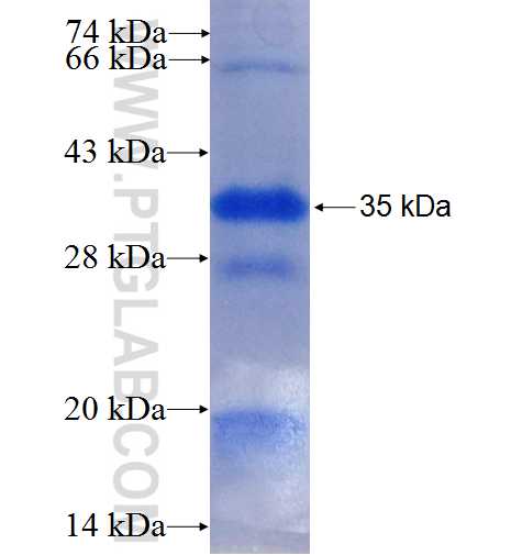FBXO31 fusion protein Ag24867 SDS-PAGE