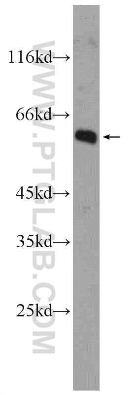 Western Blot (WB) analysis of mouse skeletal muscle tissue using FBXO32 Polyclonal antibody (12866-1-AP)