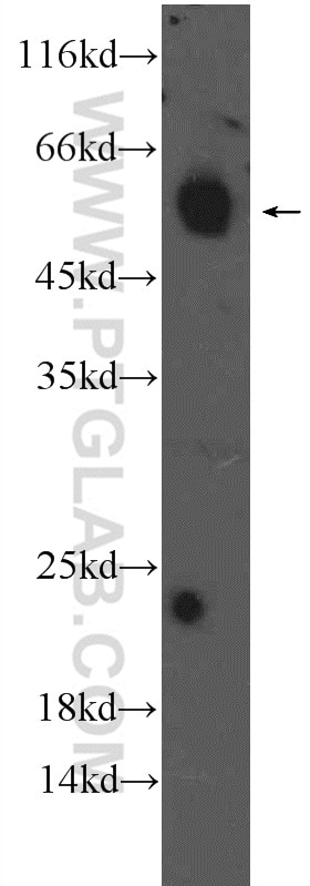 Western Blot (WB) analysis of mouse heart tissue using FBXO32 Polyclonal antibody (12866-1-AP)