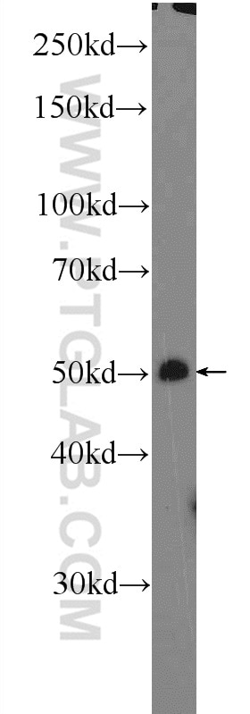 Western Blot (WB) analysis of mouse skeletal muscle tissue using FBXO32 Polyclonal antibody (12866-1-AP)