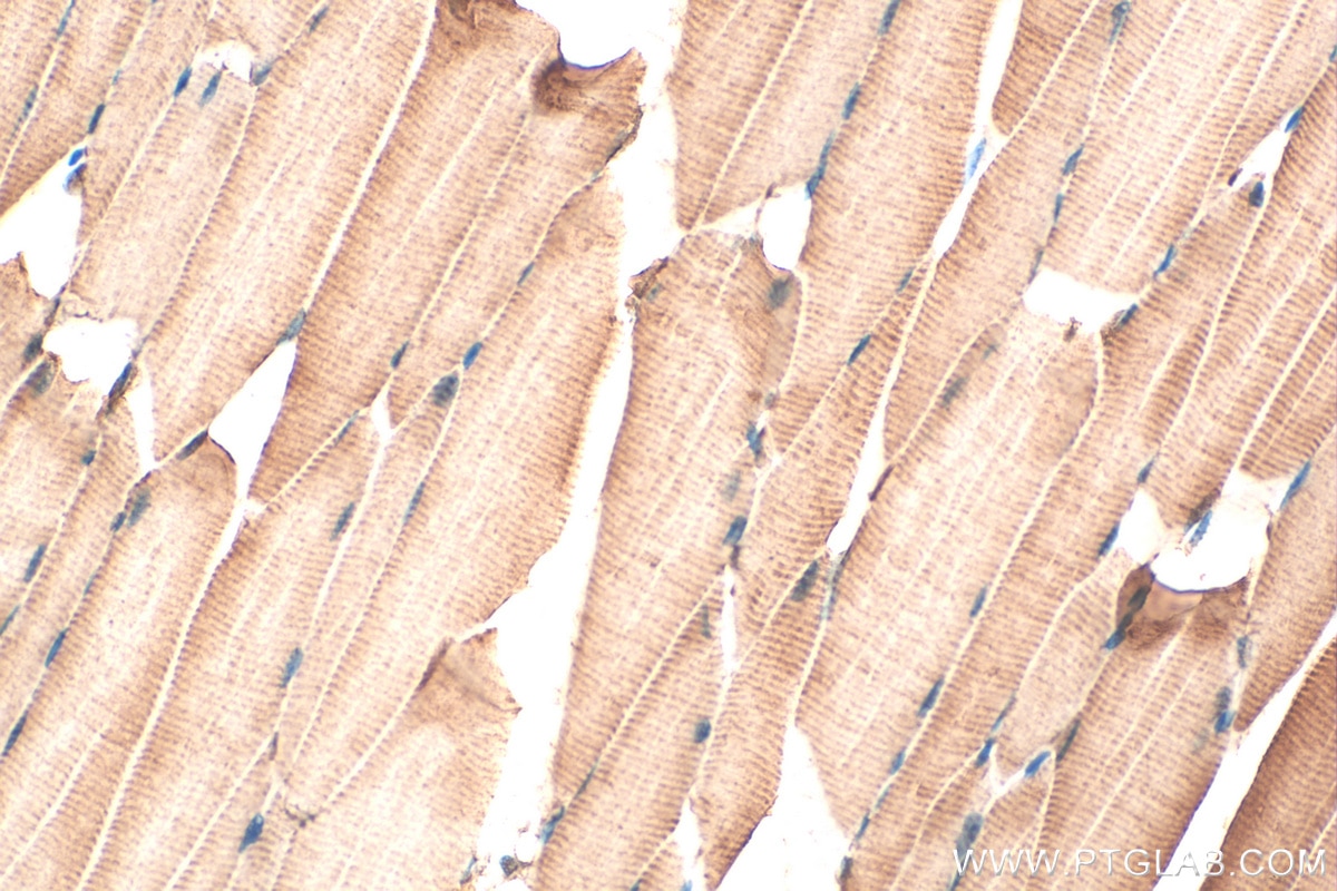 Immunohistochemistry (IHC) staining of mouse skeletal muscle tissue using FBXO32 Polyclonal antibody (28541-1-AP)