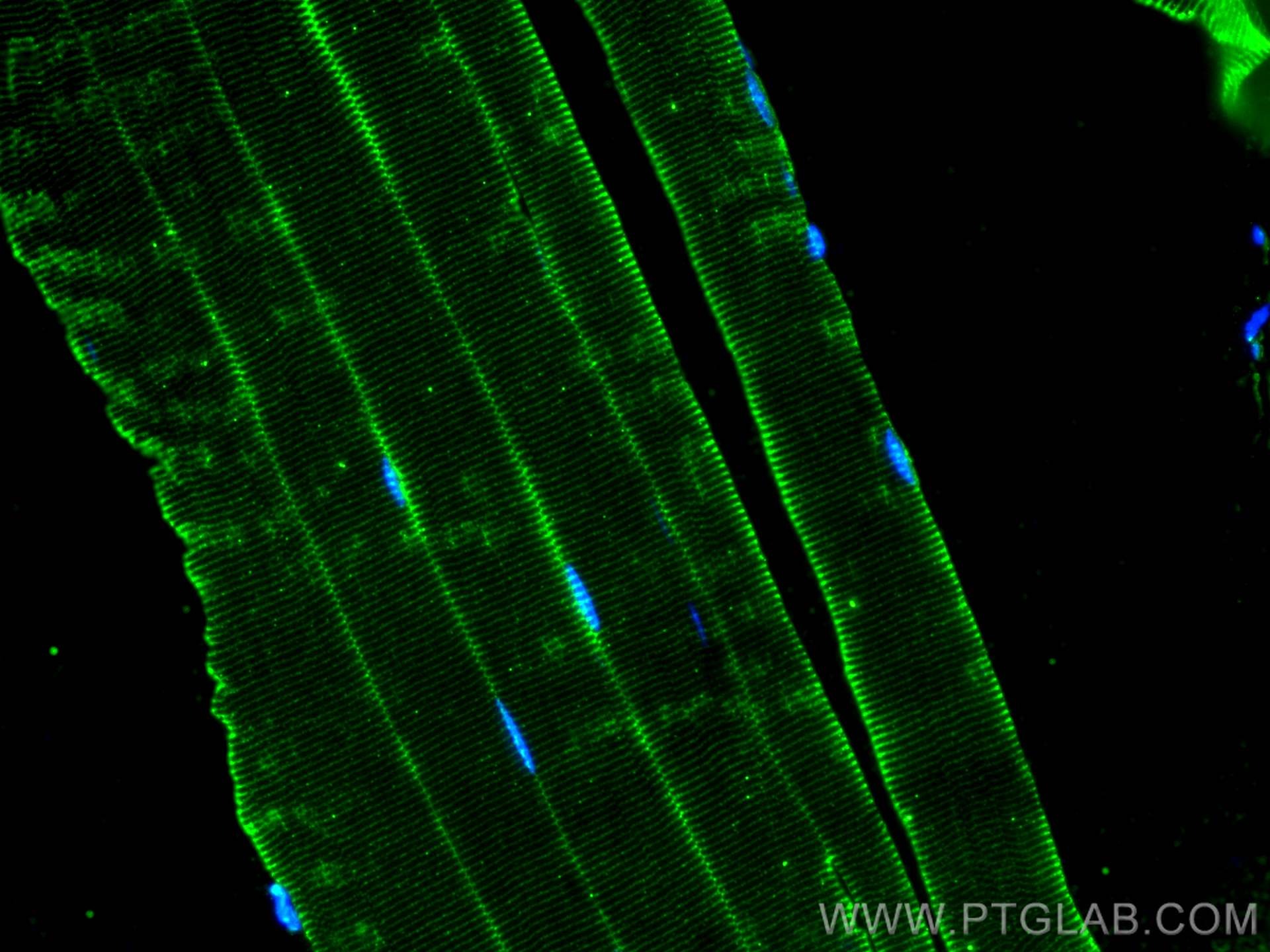 Immunofluorescence (IF) / fluorescent staining of mouse skeletal muscle tissue using FBXO32 Monoclonal antibody (67172-1-Ig)