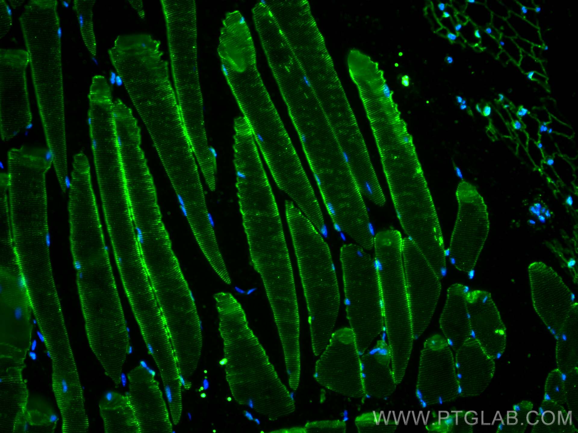 IF Staining of mouse skeletal muscle using 67172-1-Ig