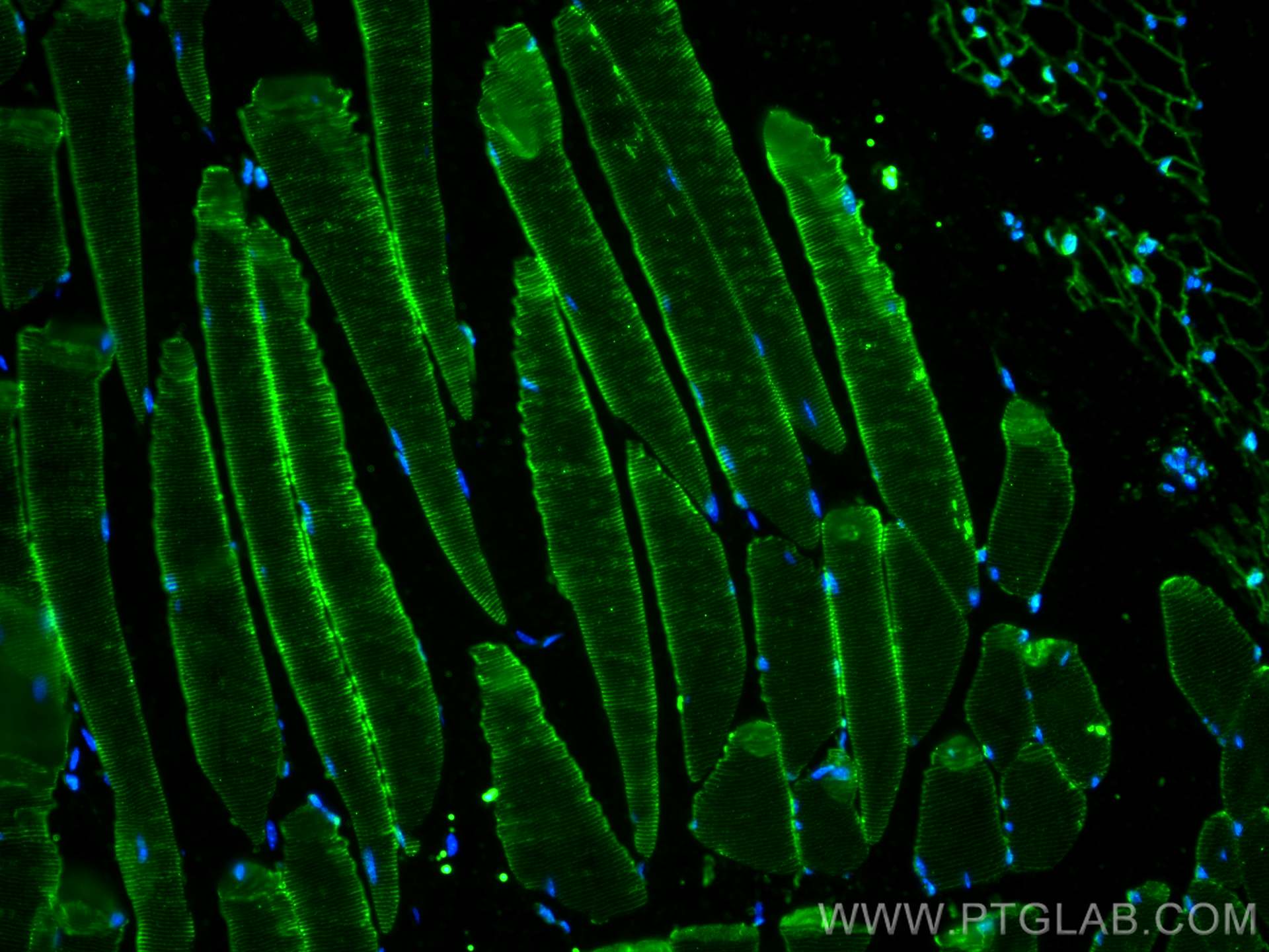 Immunofluorescence (IF) / fluorescent staining of mouse skeletal muscle tissue using FBXO32 Monoclonal antibody (67172-1-Ig)