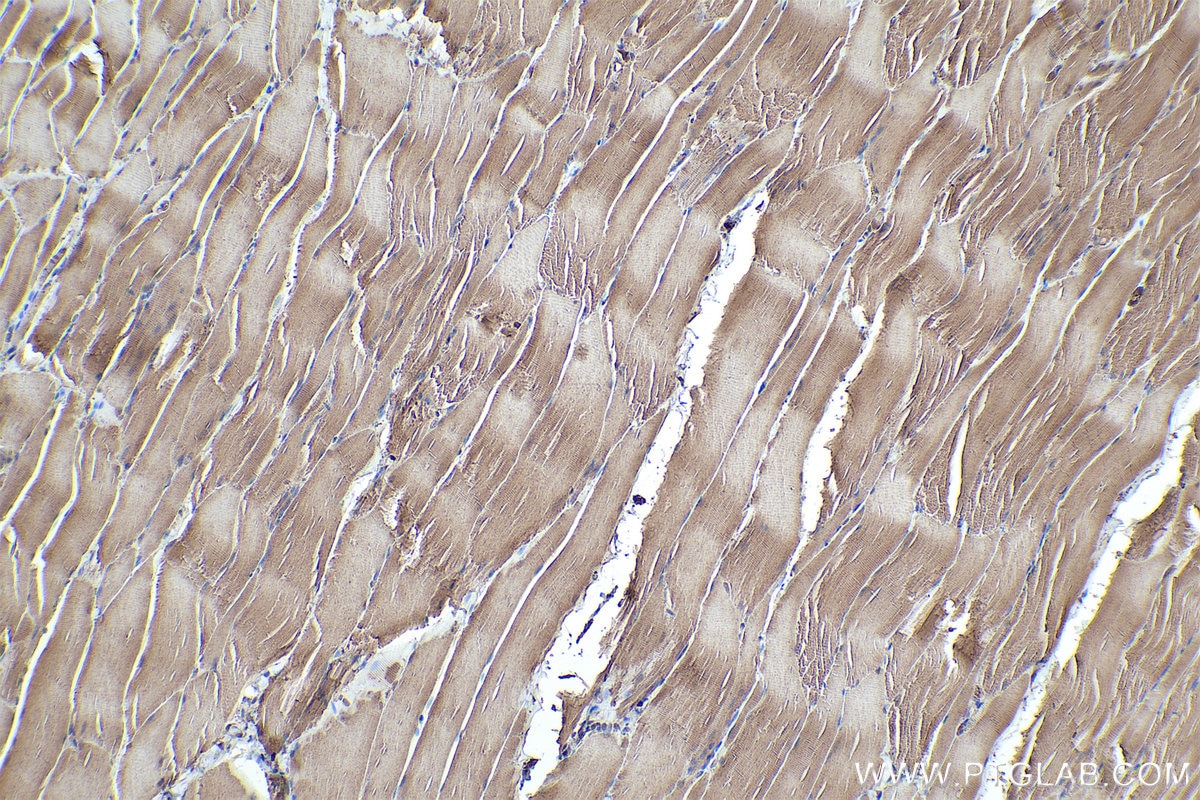 Immunohistochemistry (IHC) staining of rat skeletal muscle tissue using FBXO32 Monoclonal antibody (67172-1-Ig)