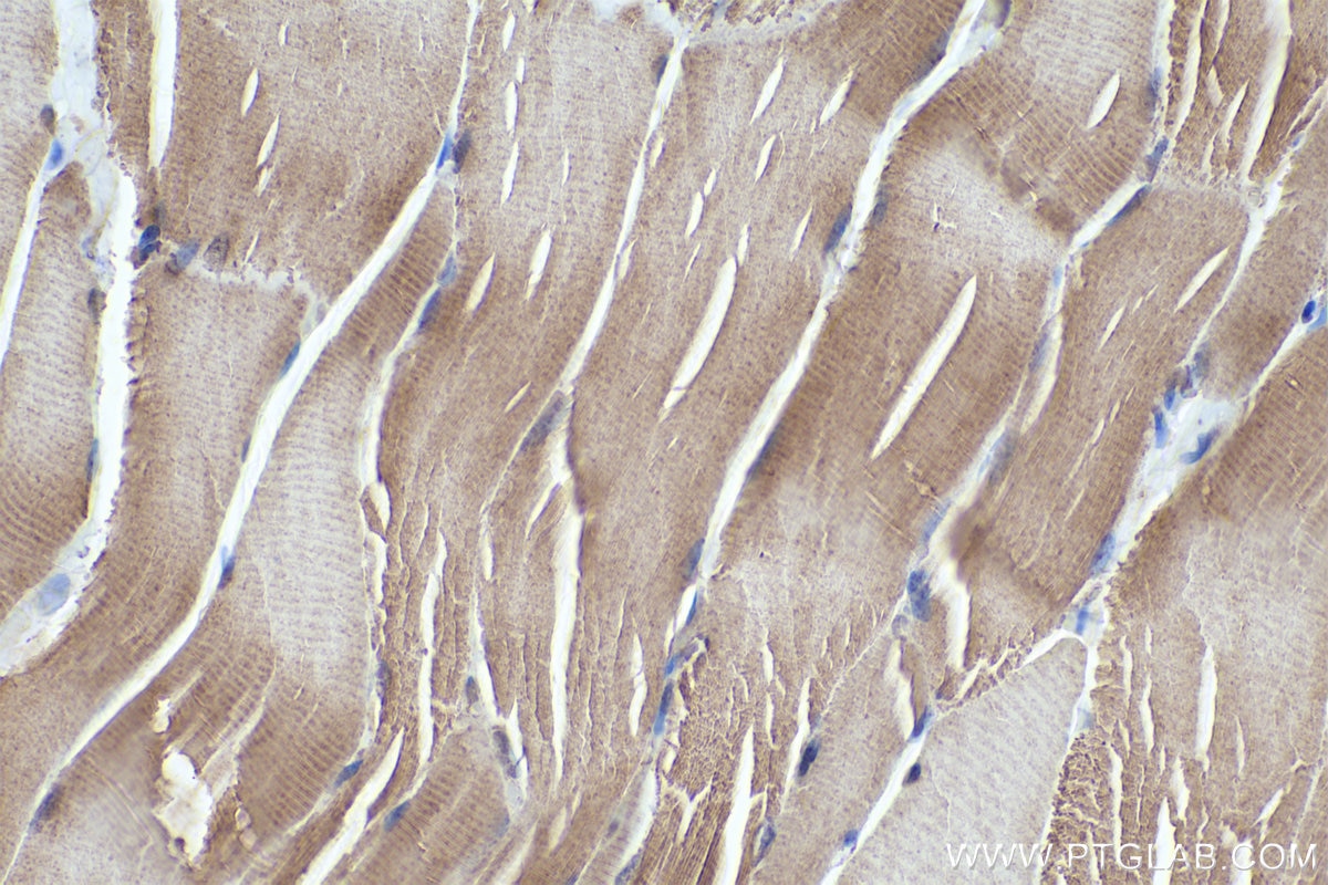 Immunohistochemistry (IHC) staining of rat skeletal muscle tissue using FBXO32 Monoclonal antibody (67172-1-Ig)
