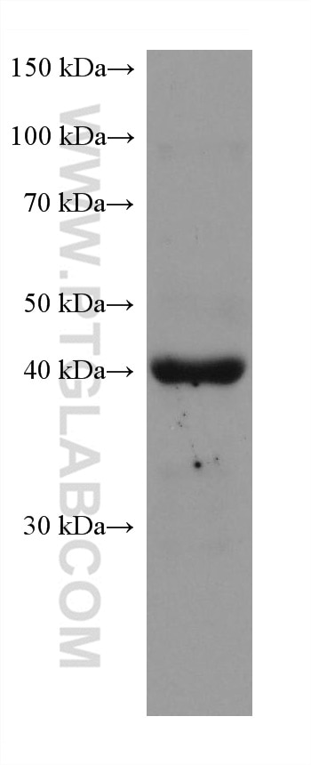 WB analysis of pig skeletal muscle using 67172-1-Ig