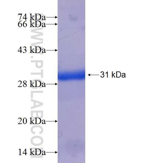 FBXO32 fusion protein Ag25247 SDS-PAGE