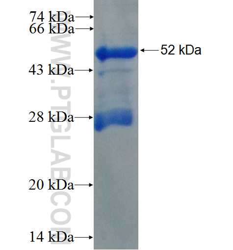FBXO32 fusion protein Ag3474 SDS-PAGE