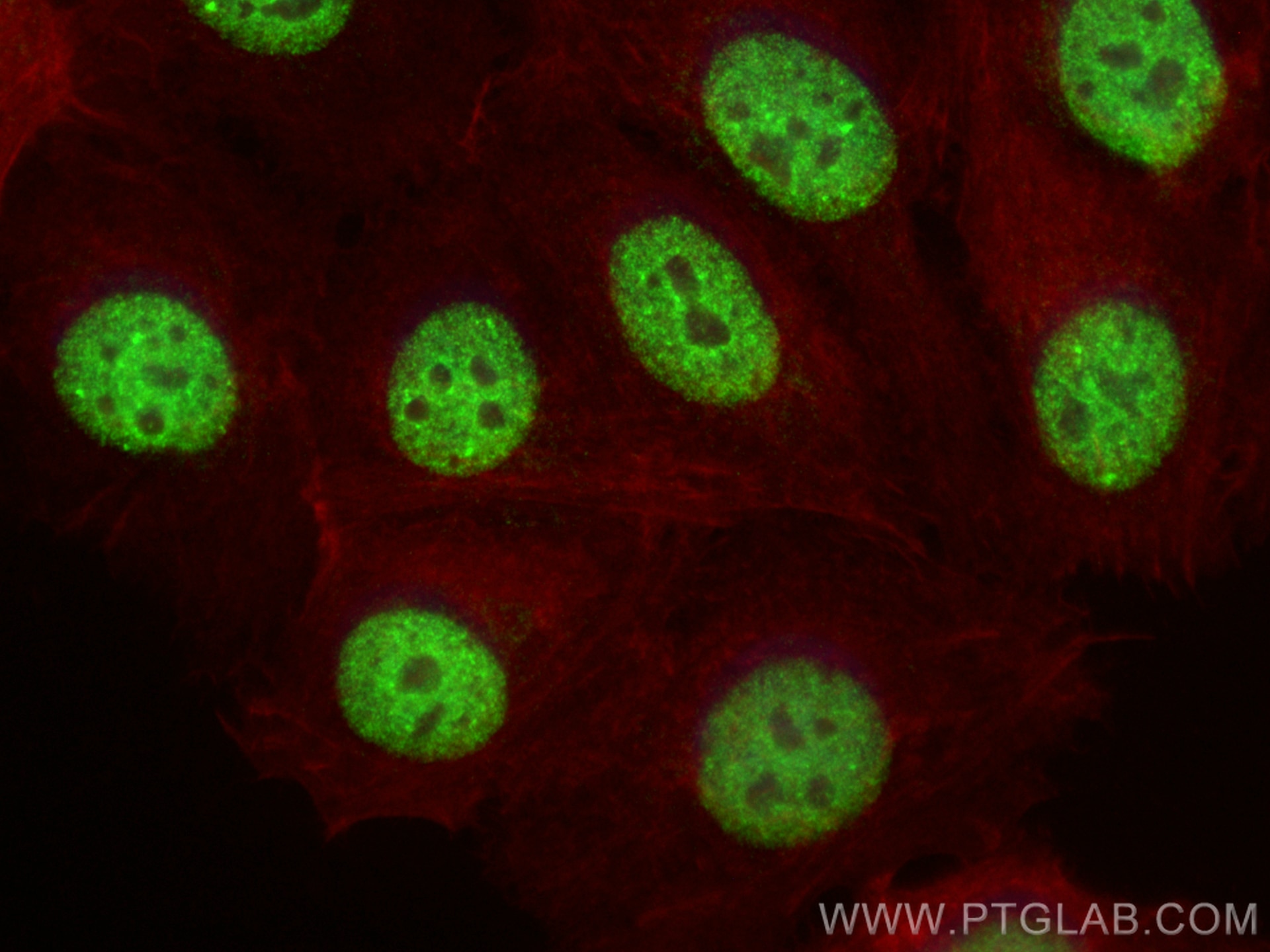 Immunofluorescence (IF) / fluorescent staining of MCF-7 cells using FBXO33 Polyclonal antibody (23381-1-AP)