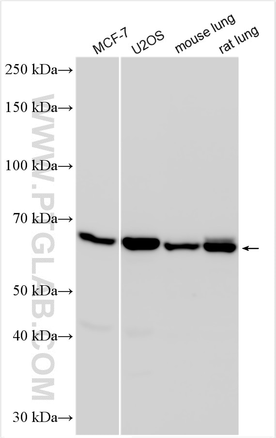 Western Blot (WB) analysis of various lysates using FBXO33 Polyclonal antibody (23381-1-AP)