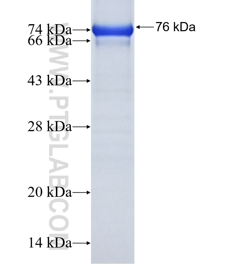 FBXO34 fusion protein Ag15372 SDS-PAGE