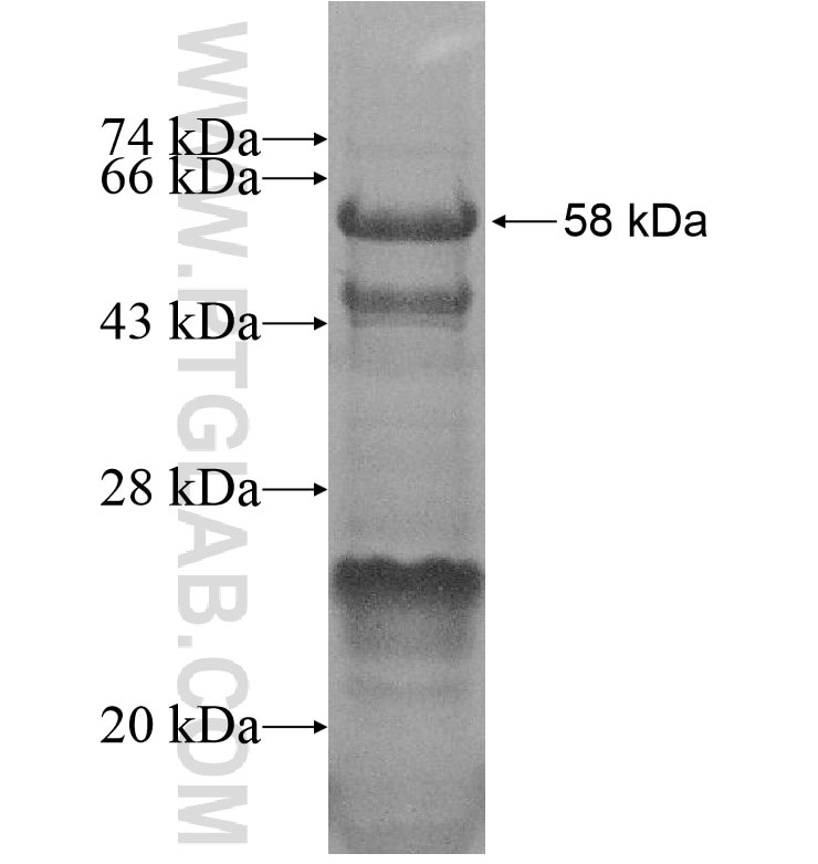 FBXO34 fusion protein Ag16919 SDS-PAGE