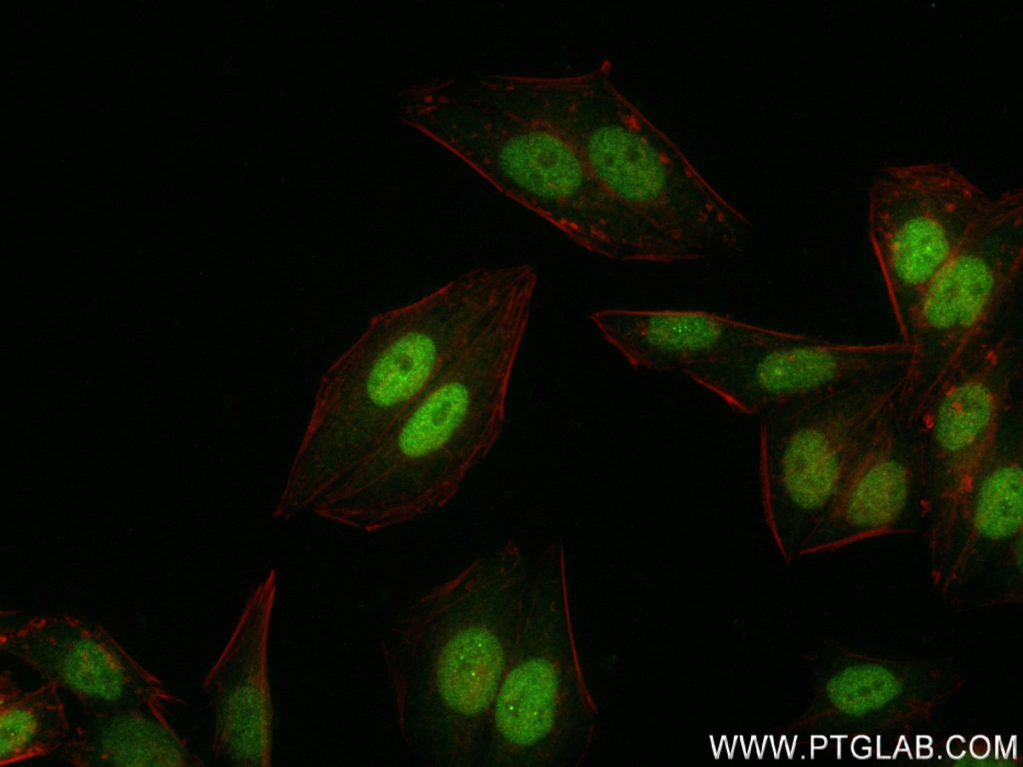 Immunofluorescence (IF) / fluorescent staining of HepG2 cells using FBXO38 Recombinant antibody (83509-5-RR)