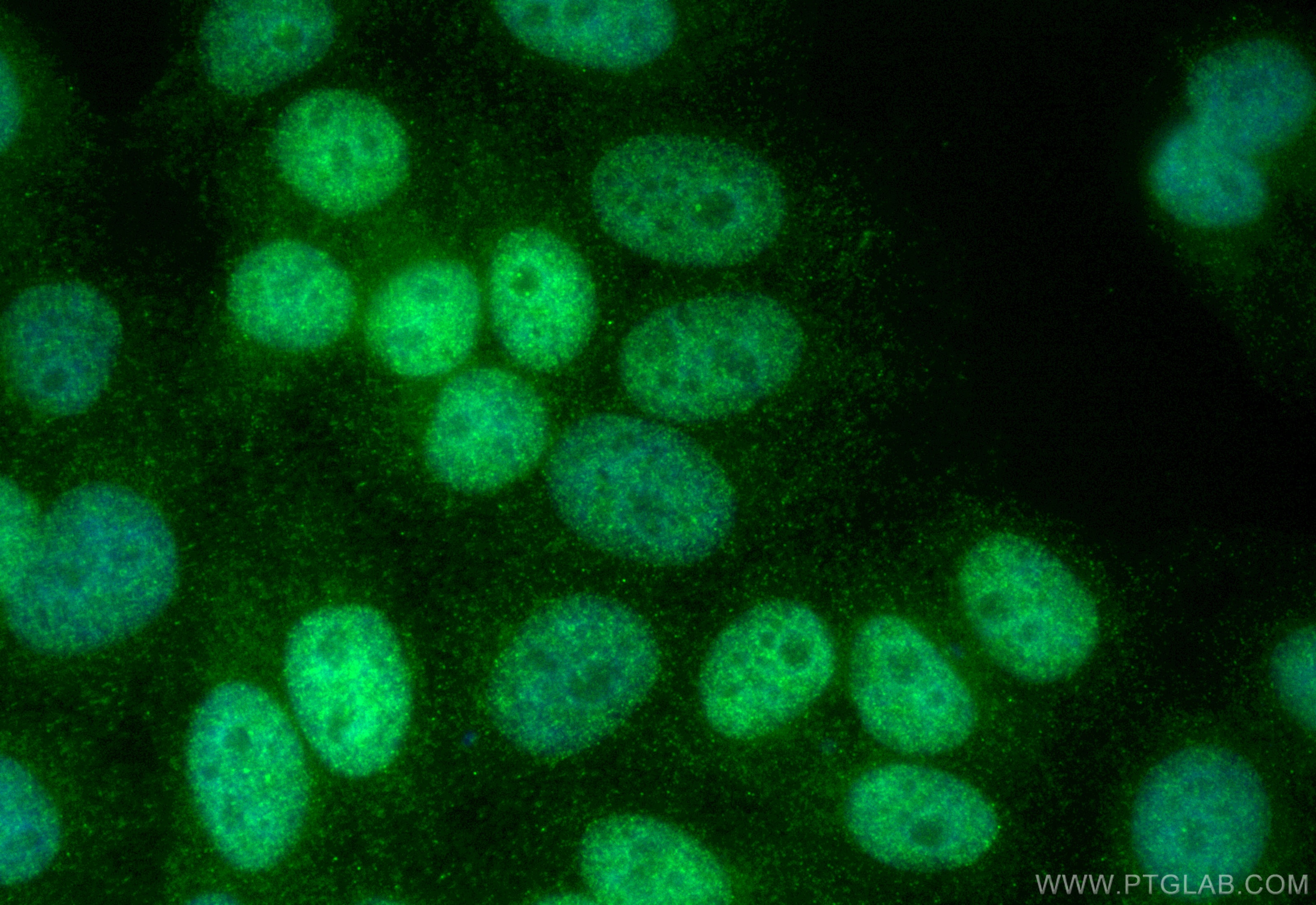 Immunofluorescence (IF) / fluorescent staining of HepG2 cells using CoraLite® Plus 488-conjugated FBXO38 Recombinant a (CL488-83509-5)