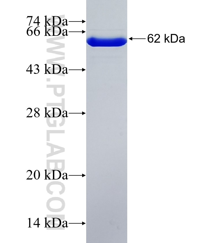 FBXO38 fusion protein Ag35444 SDS-PAGE