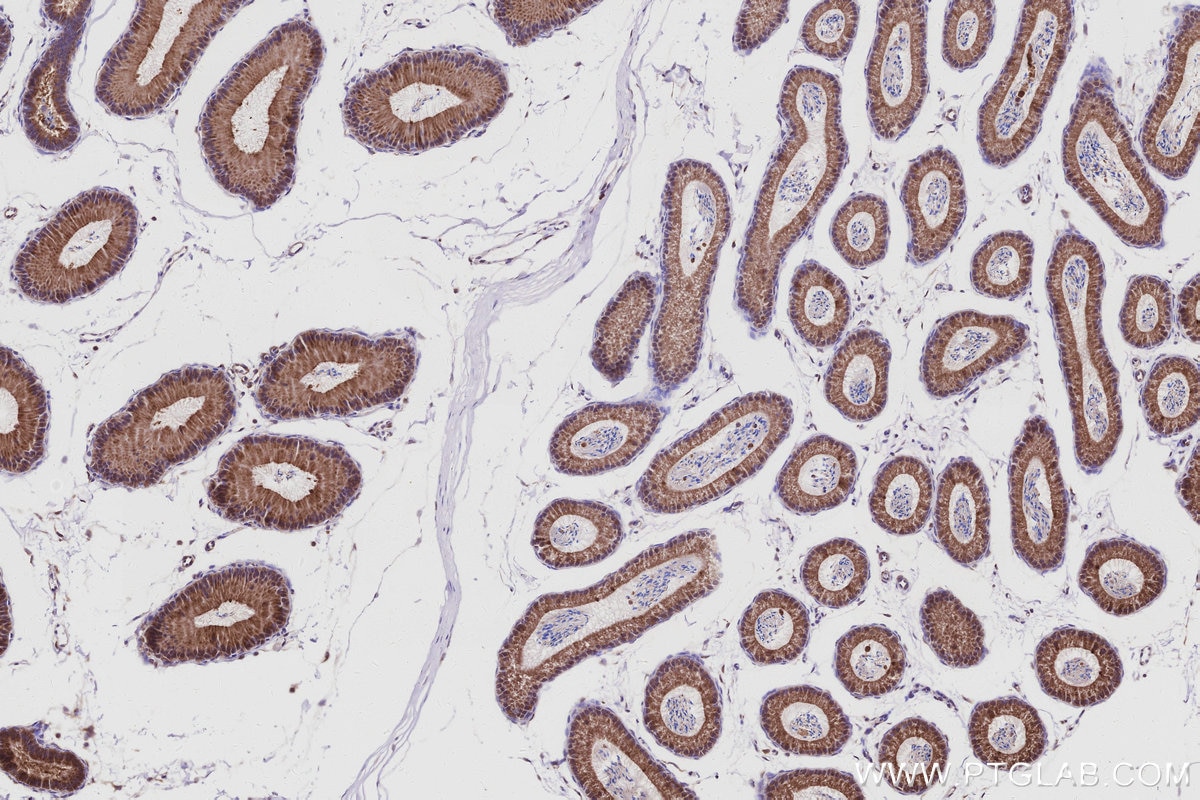 Immunohistochemistry (IHC) staining of mouse epididymis tissue using FBX4 Polyclonal antibody (13855-1-AP)