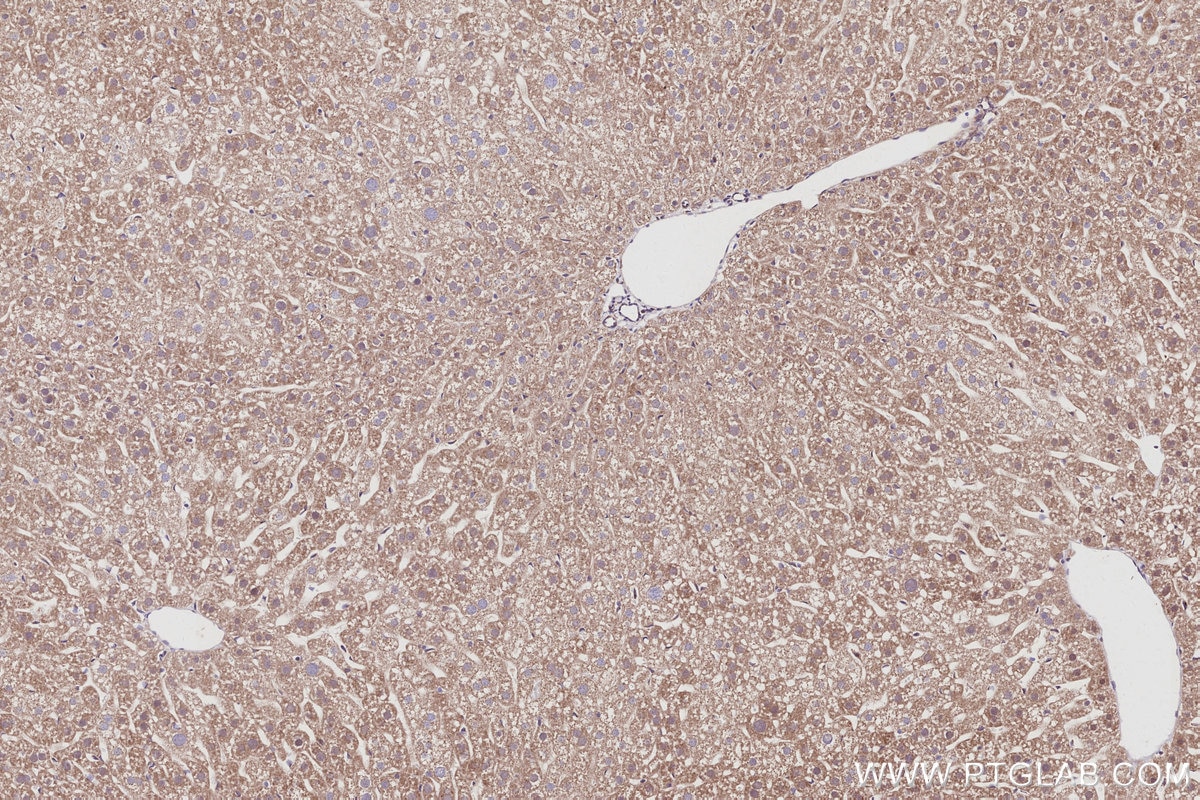 Immunohistochemistry (IHC) staining of mouse liver tissue using FBX4 Polyclonal antibody (13855-1-AP)