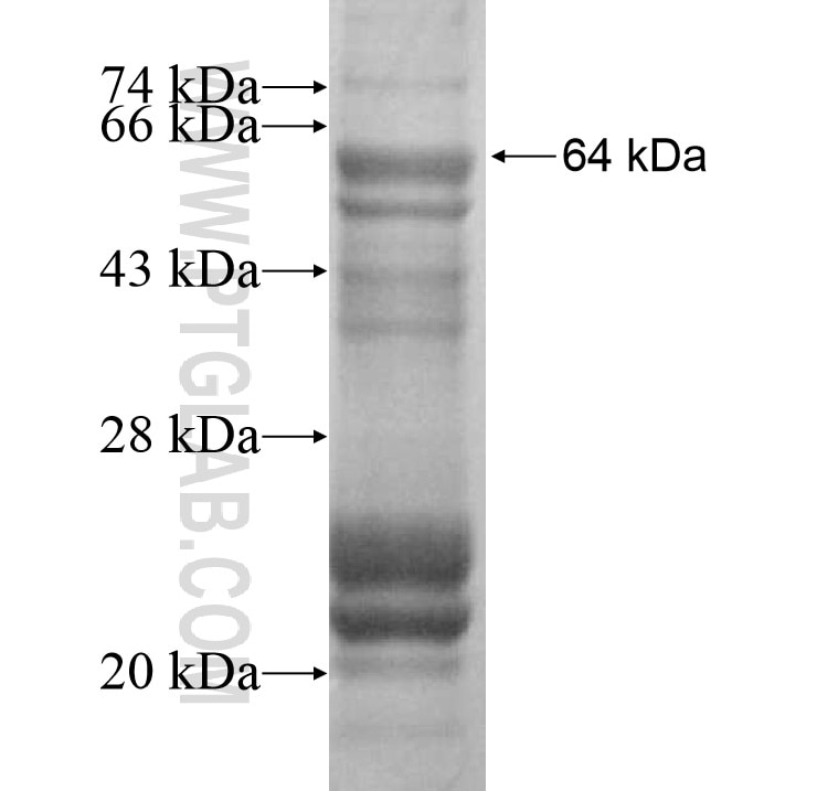 FBXO40 fusion protein Ag16272 SDS-PAGE