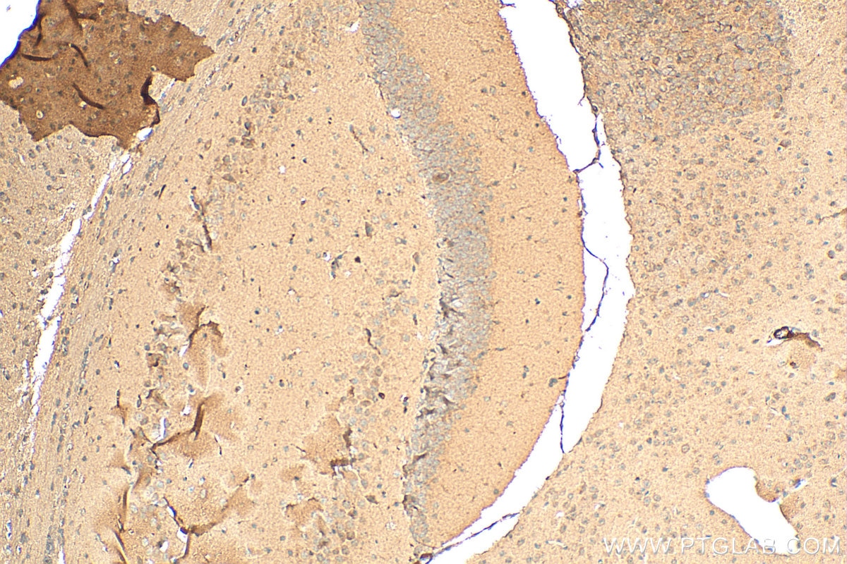 IHC staining of mouse brain using 24519-1-AP