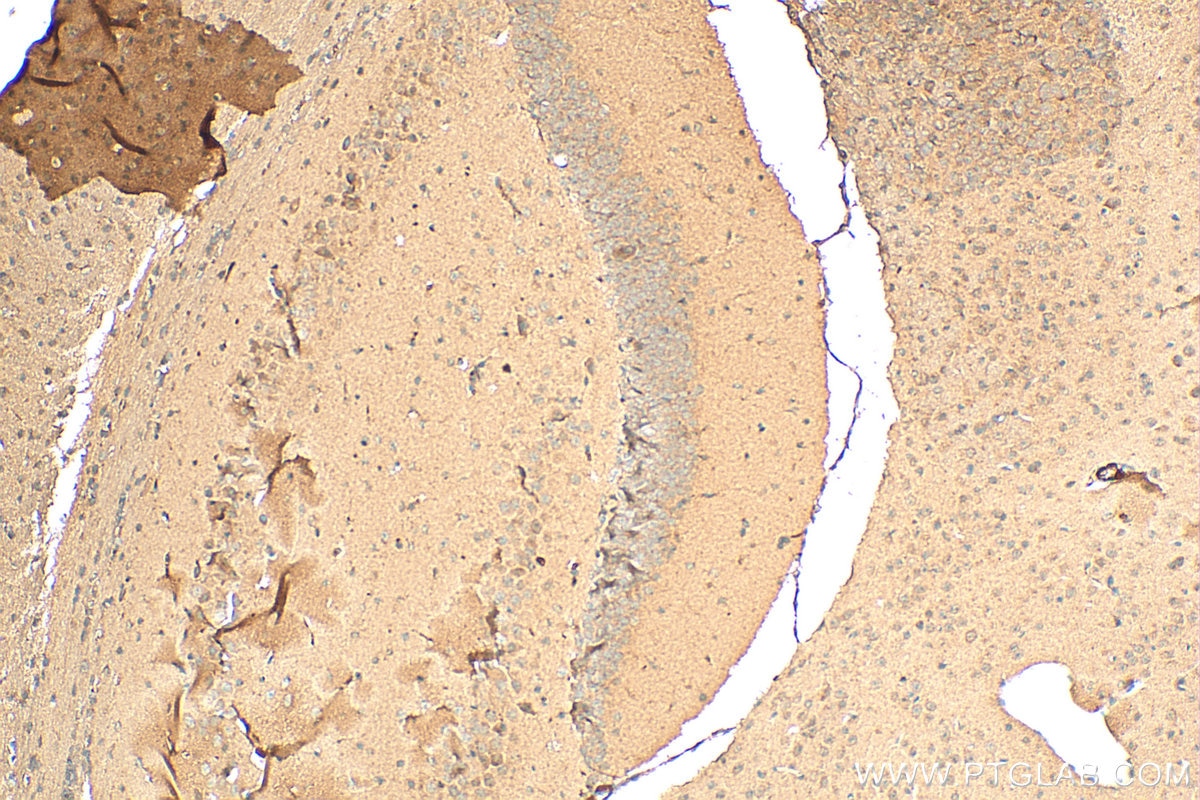 Immunohistochemistry (IHC) staining of mouse brain tissue using FBXO41 Polyclonal antibody (24519-1-AP)