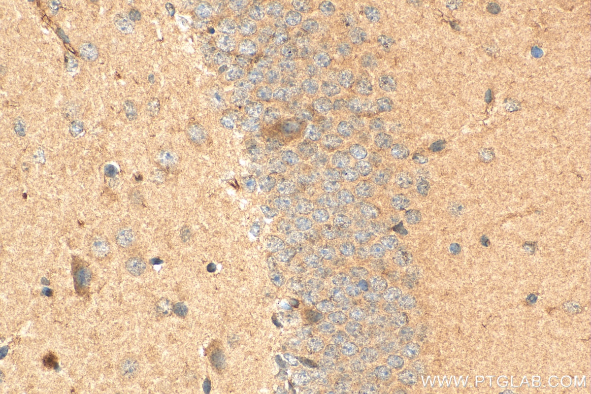 Immunohistochemistry (IHC) staining of mouse brain tissue using FBXO41 Polyclonal antibody (24519-1-AP)