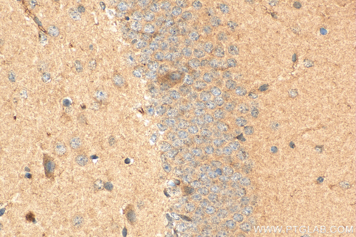 IHC staining of mouse brain using 24519-1-AP