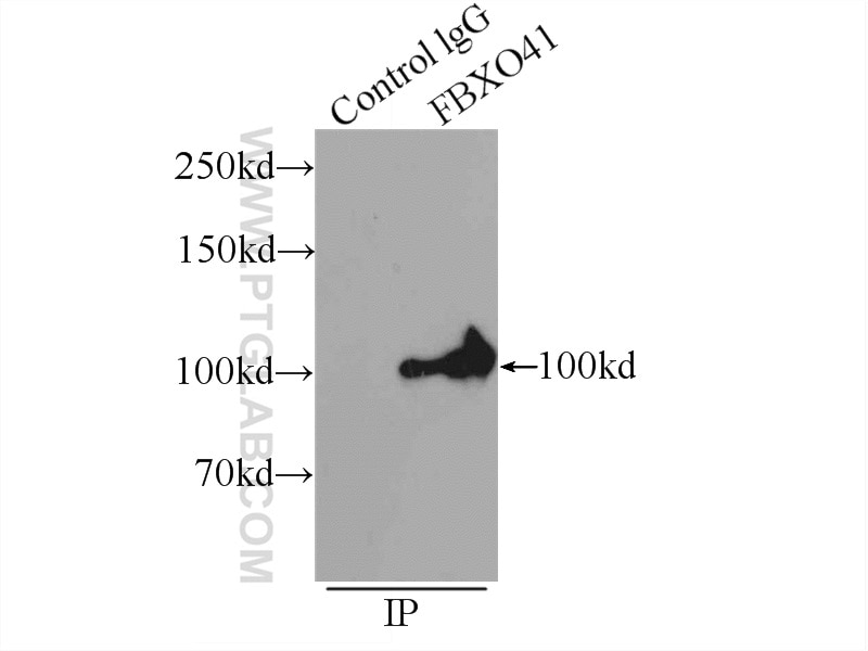 Immunoprecipitation (IP) experiment of mouse brain tissue using FBXO41 Polyclonal antibody (24519-1-AP)