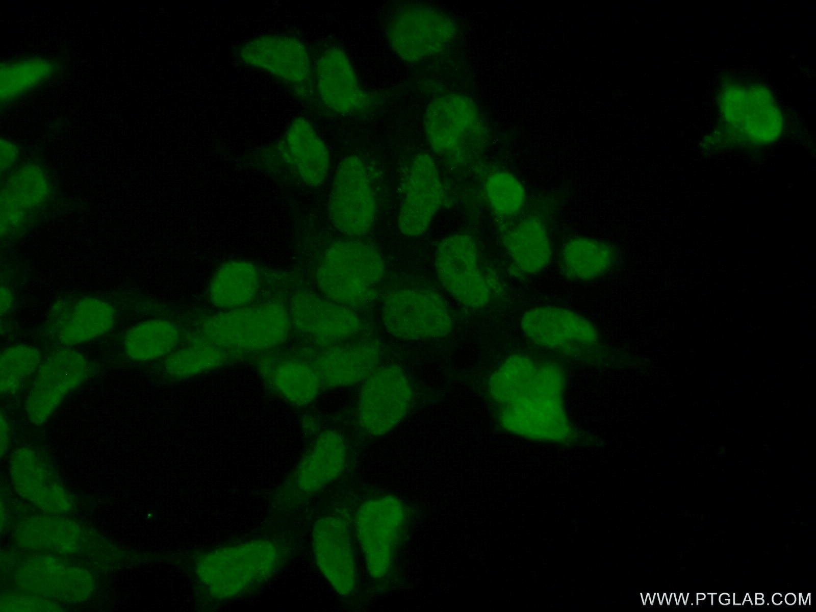 Immunofluorescence (IF) / fluorescent staining of HEK-293 cells using FBXO43 Polyclonal antibody (55176-1-AP)