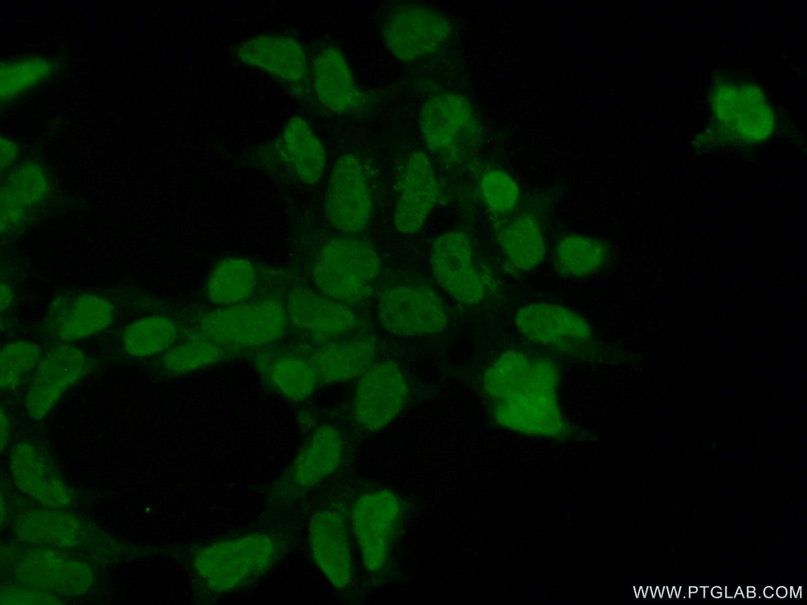 IF Staining of HEK-293 using 55176-1-AP