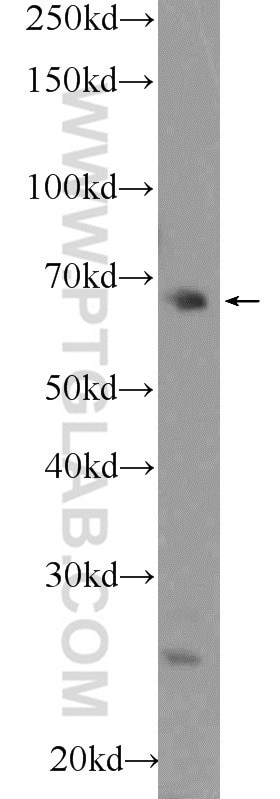 Western Blot (WB) analysis of HEK-293 cells using FBXO43 Polyclonal antibody (55176-1-AP)