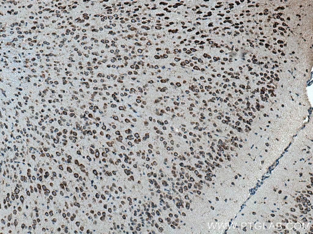 Immunohistochemistry (IHC) staining of mouse brain tissue using FBXO44 Polyclonal antibody (10626-1-AP)