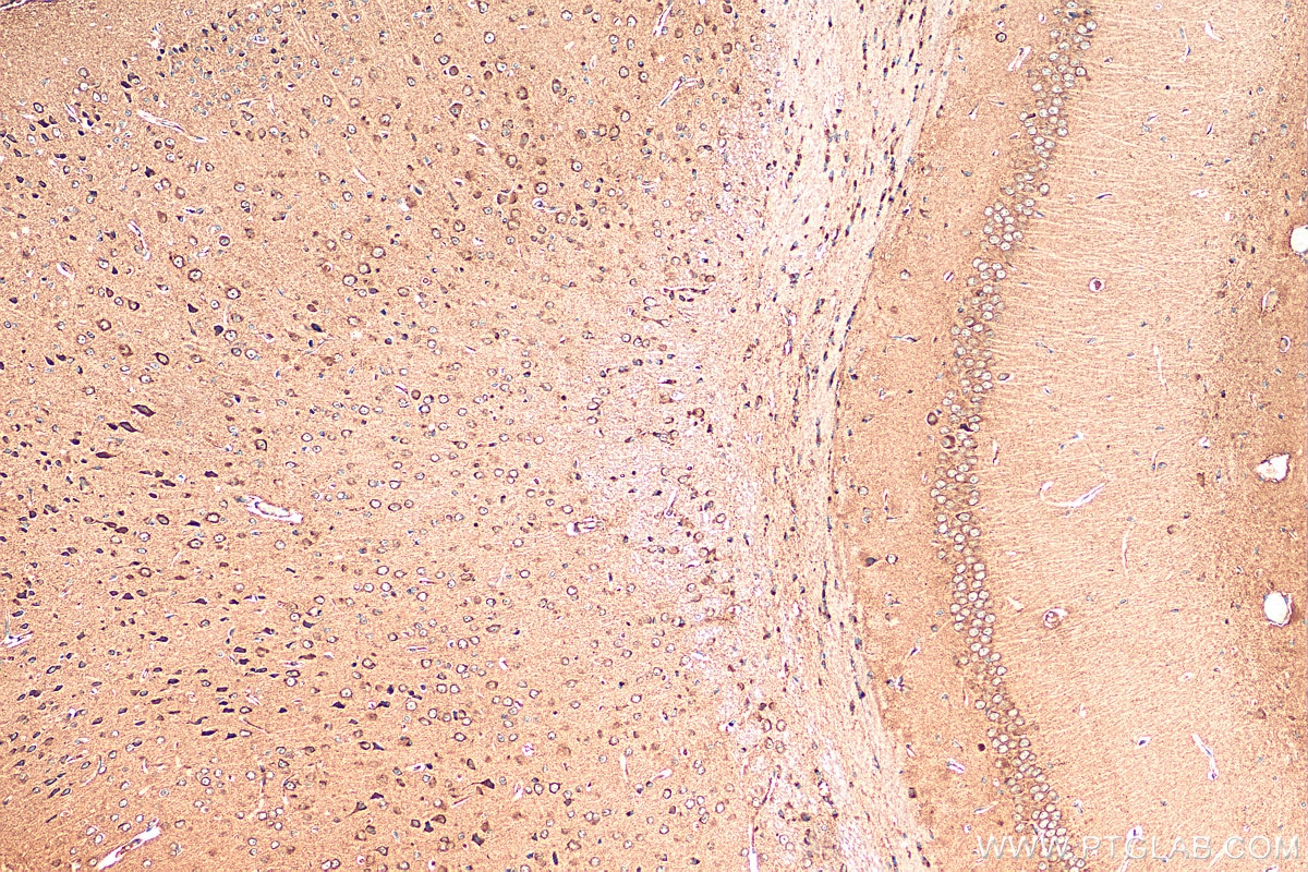 Immunohistochemistry (IHC) staining of mouse brain tissue using FBXO44 Polyclonal antibody (10626-1-AP)