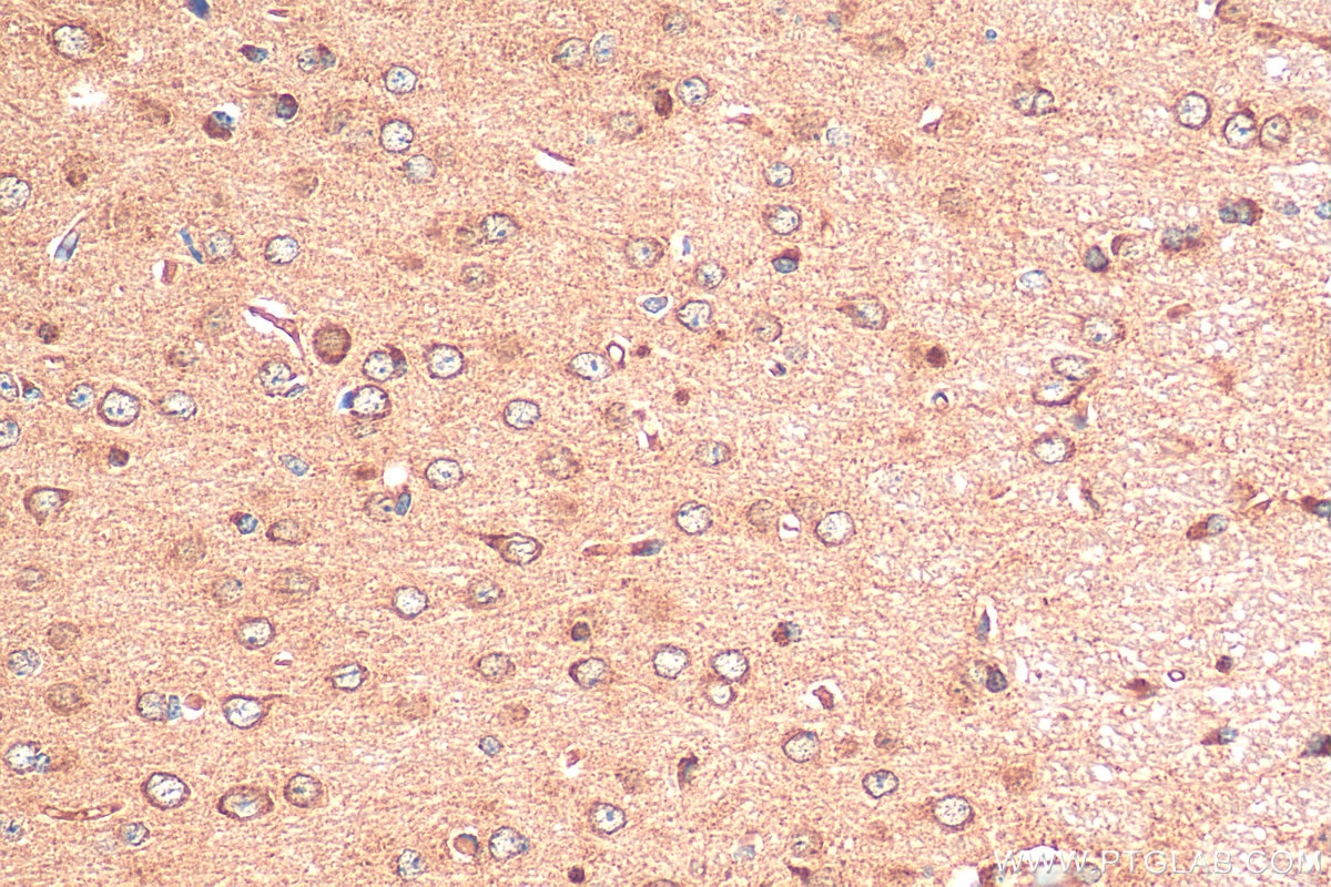 Immunohistochemistry (IHC) staining of mouse brain tissue using FBXO44 Polyclonal antibody (10626-1-AP)