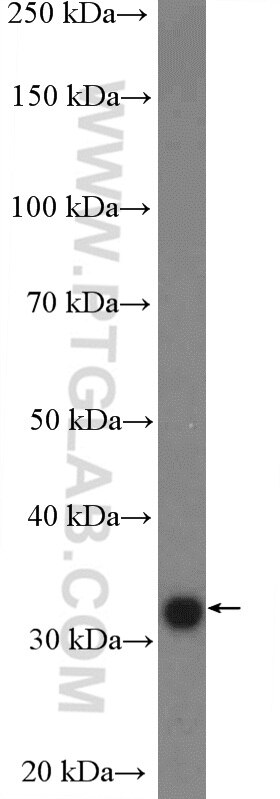 FBXO44 Polyclonal antibody