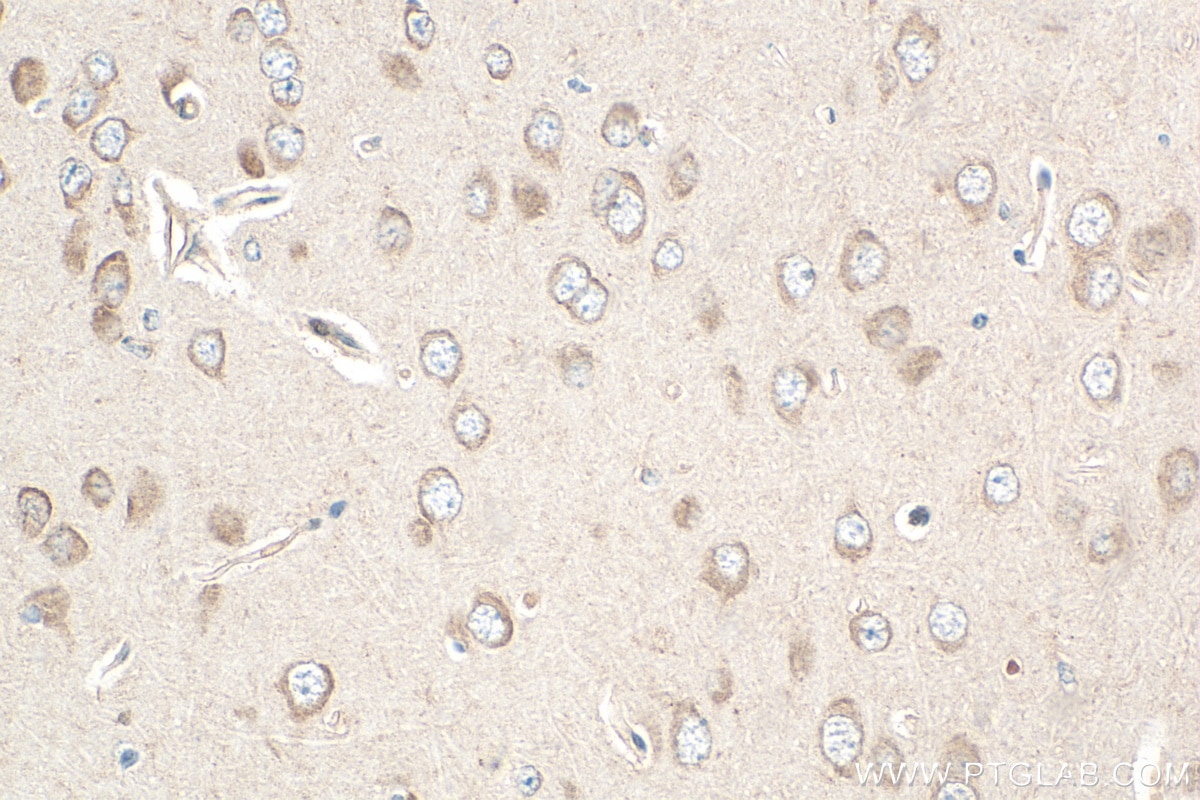 Immunohistochemistry (IHC) staining of mouse brain tissue using FBXO44 Polyclonal antibody (30162-1-AP)