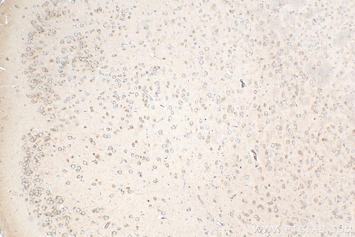 Immunohistochemistry (IHC) staining of mouse brain tissue using FBXO44 Polyclonal antibody (30162-1-AP)