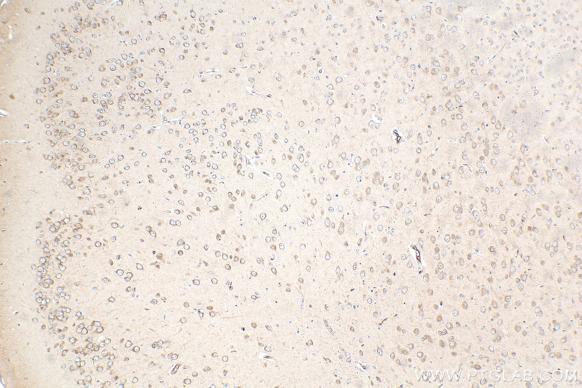 IHC staining of mouse brain using 30162-1-AP