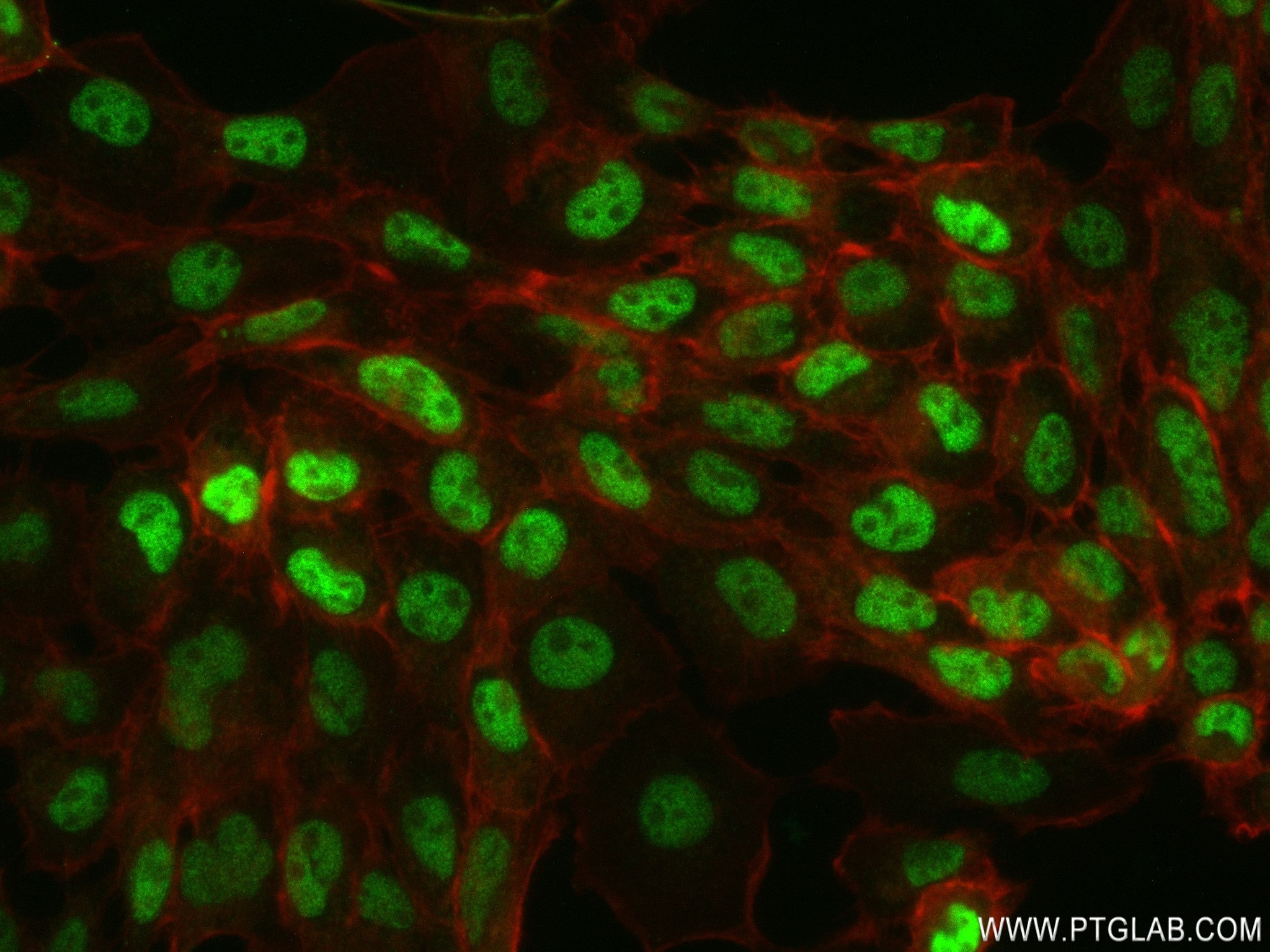Immunofluorescence (IF) / fluorescent staining of A431 cells using FBXO44 Recombinant antibody (82857-2-RR)