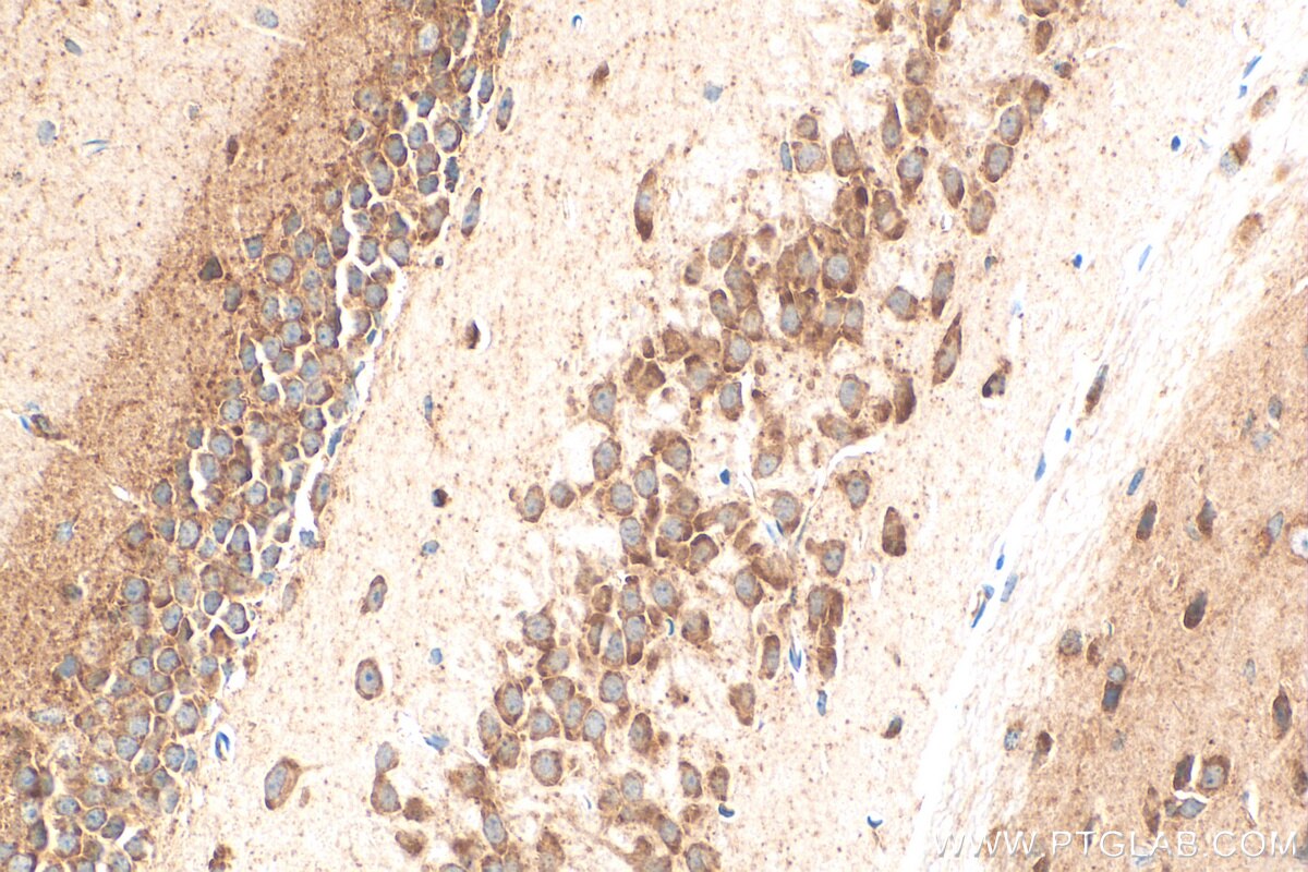 Immunohistochemistry (IHC) staining of mouse brain tissue using FBXO44 Recombinant antibody (82857-2-RR)